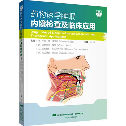 药物诱导睡眠内镜检查及临床应用——德懋科技的技术创新与实践